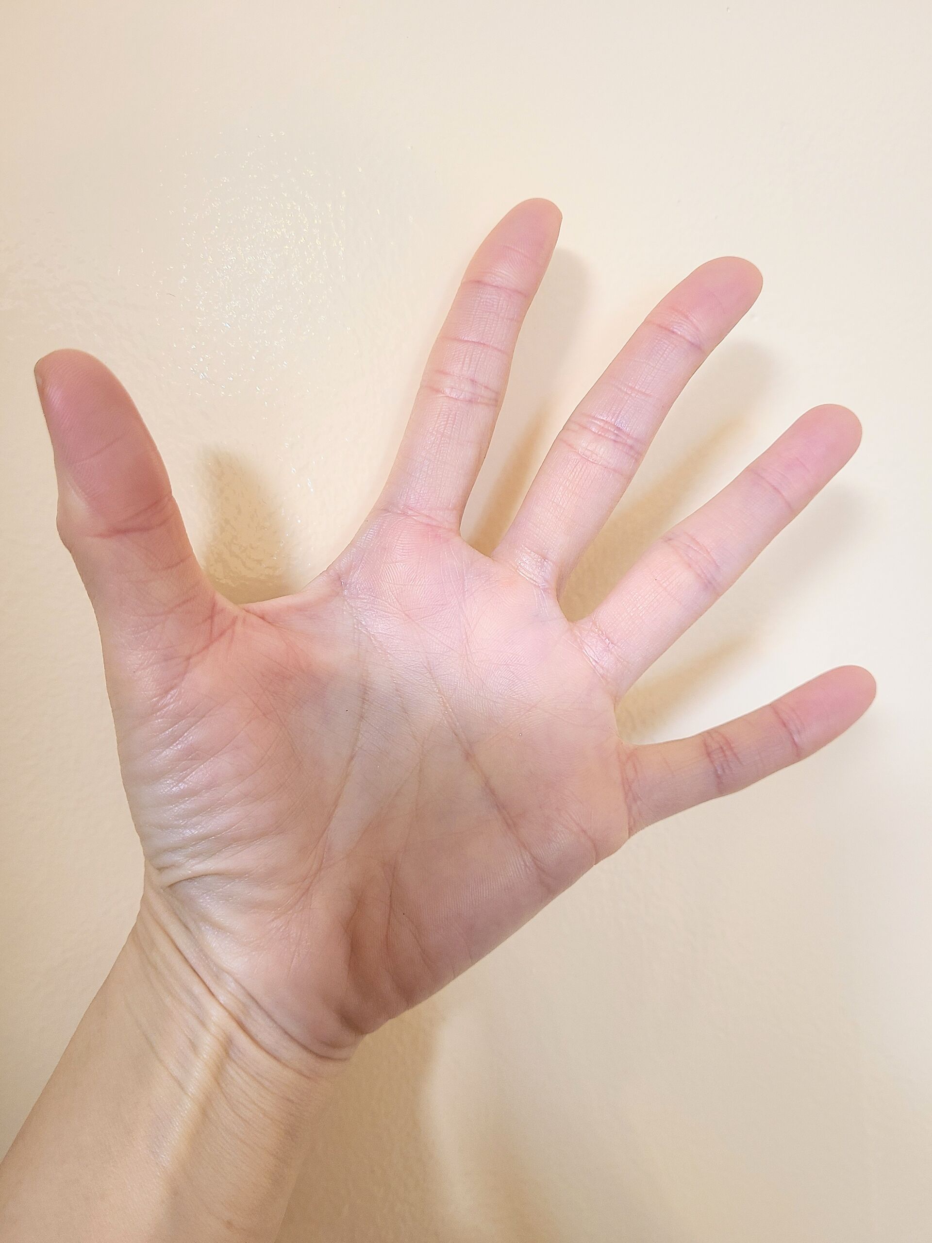 MV